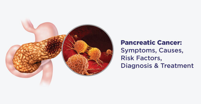 Sarcomas: Causes, Types, Symptoms, Diagnosis & Treatment 